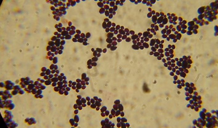 Microscopia de Fungos Filamentosos (BOLORES) e Fungos Leveduriformes ...